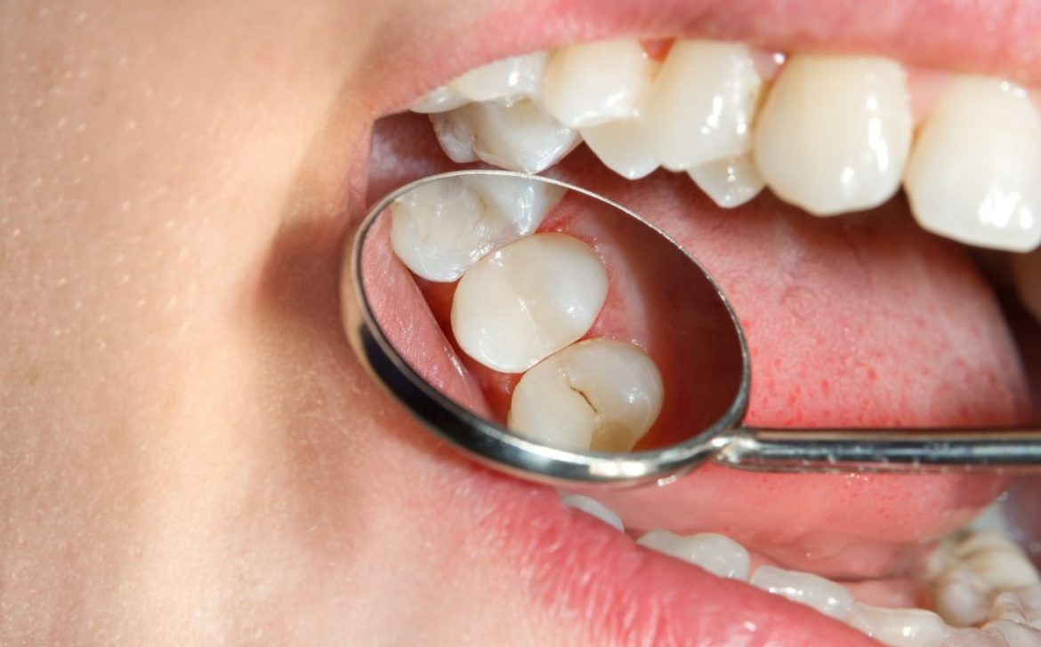 Enfermedades bucales afectan a millones y comprometen salud integral según la Organización Mundial